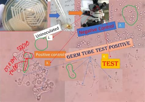 Germ Tube Test Gtt For Candida Introduction Principle Procedure