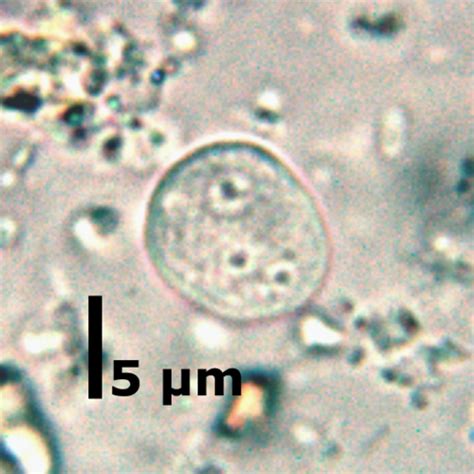 Endolimax Nana Parasite Diagnosis