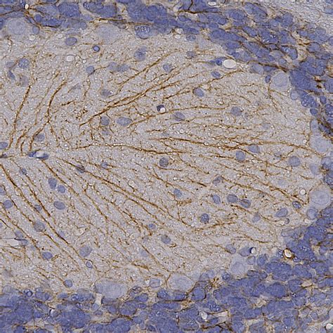 Chicken Polyclonal Antibody To GFAP Cat CPCA GFAP EnCor Biotechnology