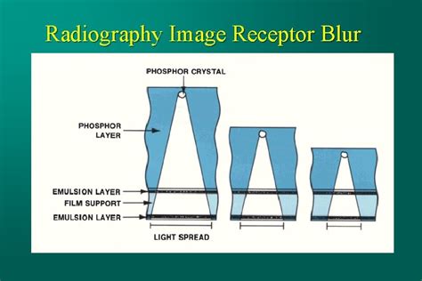 Digital Radiography Basic Concepts N Image Quality Concepts