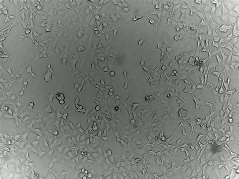 Monitoring HEK293 cell culture inside an incubator - ioLight