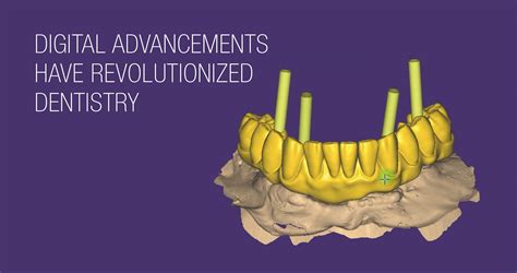 Comprehensive Dental Rehabilitation With Digital Workflow