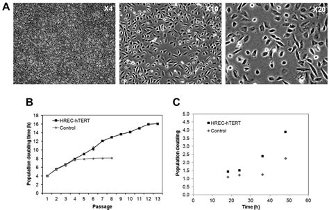 Establishment Of Human Retinal Microvascular Endothelial Cells With