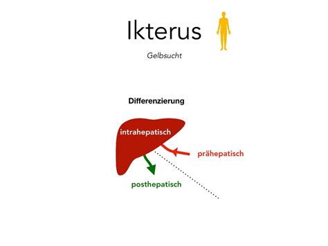 Ikterus Gastroenterologie