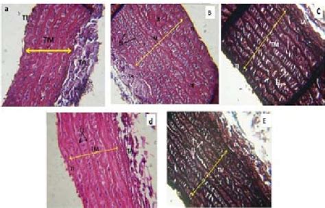 Representation Histological Sections Of The Thoracic Aorta From A