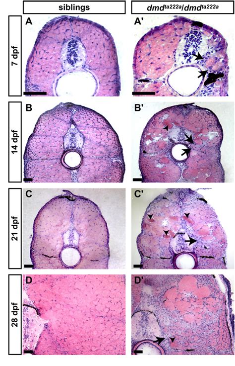 Figure 1 From Dystrophin Deficient Zebrafish Feature Aspects Of The