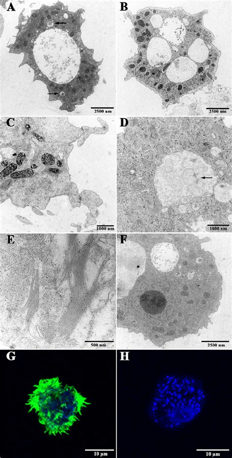 Ultrastructure Of Acanthamoeba Sp Myp2004 As Observed By Tem And Download Scientific Diagram