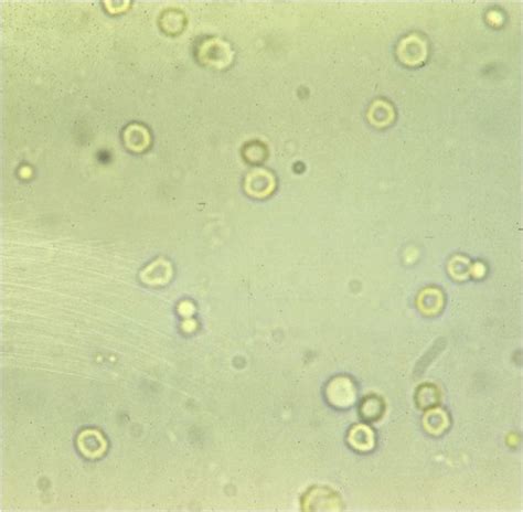 Microscopic Urinalysis Flashcards Quizlet