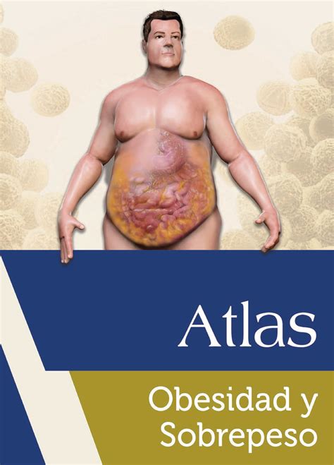 Atlas Obesidad Y Sobrepeso Definición De Obesidad Y Sobrepeso De