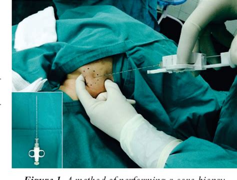 Figure From Validity Of Core Needle Biopsy In The Histopathological