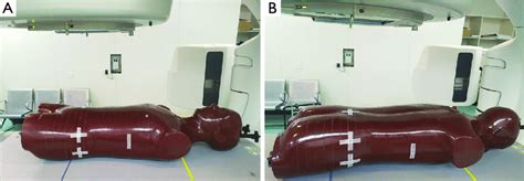 The Anthropomorphic Phantom A Supine Position B Prone Position Download Scientific Diagram