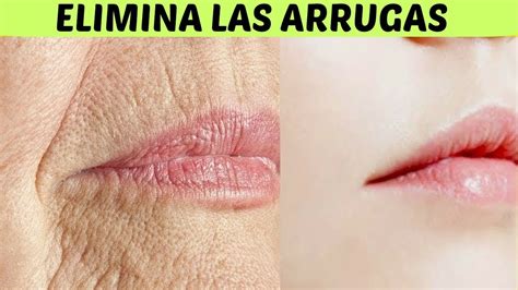 COMO ELIMINAR LAS ARRUGAS DEL ROSTRO YouTube