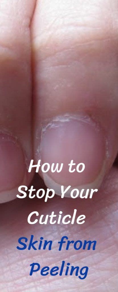 How To Stop Your Cuticle Skin From Peeling Cuticle Cuticle Treatment