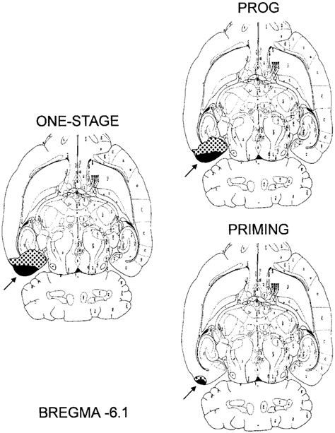 Minimum and maximum extent of entorhinal lesions. As the examples of ...