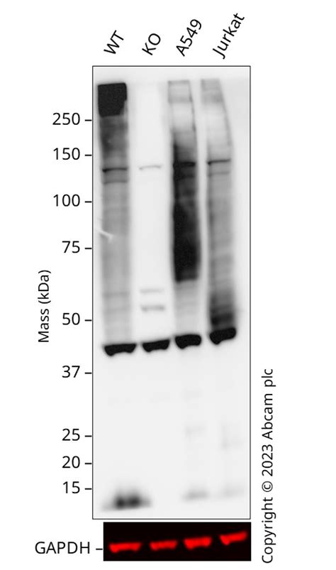 Glucose Transporter Glut1重组抗体 Epr3915 Glucose Transporter Glut1抗体