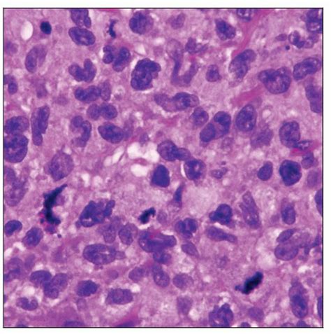 Langerhans Cells Histology