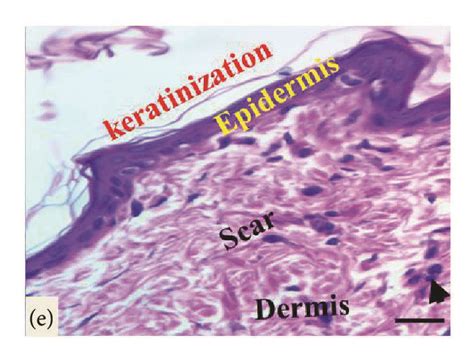 Light Micrograph Sections Of The Cutaneous Wound Section At Two Months Download Scientific