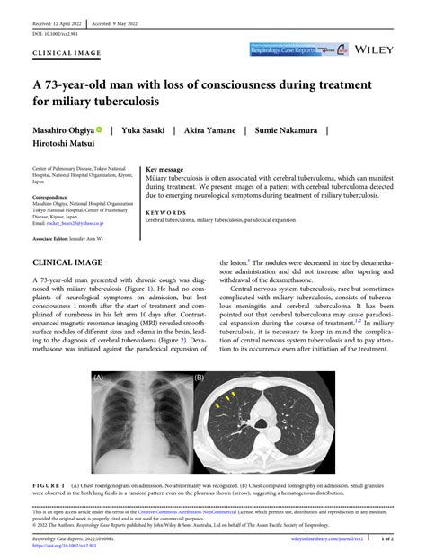 Pdf A 73‐year‐old Man With Loss Of Consciousness During Treatment For Miliary Tuberculosis