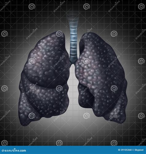 Human Lung Illness Anatomy Diagram Lung Cancer Asthma Tuberculosis