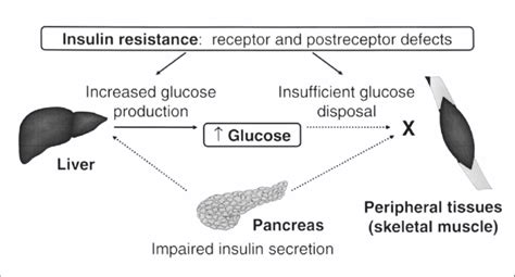 Causes Of Hyperglycemia In Type 2 Diabetes 19 Slika 1 Uzroci