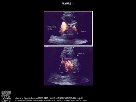 Pyng Lee Md Henri G Colt Md Fccp Journal Of Thoracic Oncology