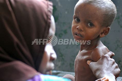 【写真特集】東アフリカで深刻な干ばつ、内戦と二重苦のソマリアで大量の難民 写真20枚 国際ニュース：afpbb News