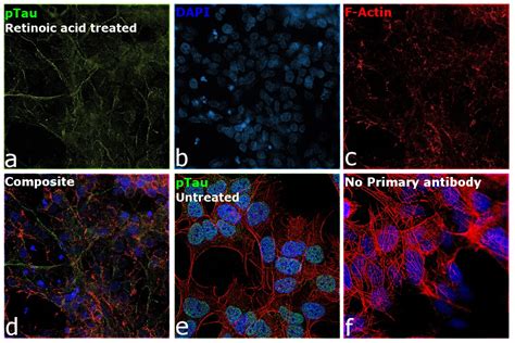 Phospho Tau Ser202 Thr205 Antibody Mn1020