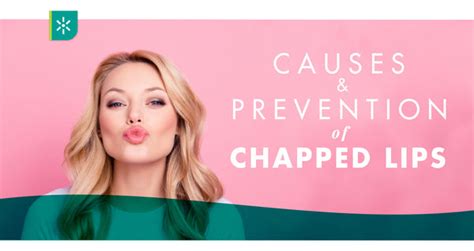 Pucker Up Easy Ways To Prevent Chapped Lips 💋 Shop Bestderm