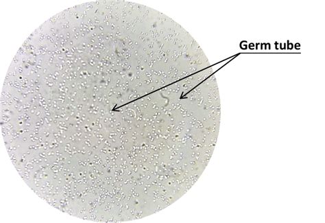 Germ Tube Of Candida Download Scientific Diagram