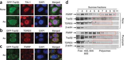 Top3β associates with TDRD3 and FMRP in stress granules and