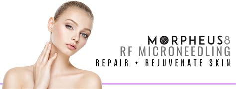 Morpheus8 Dallas Tx Skin Rejuvenation In Dfw