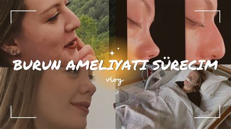 BURUN AMELİYATI SÜRECİM 5 GÜNDE İYİLEŞTİM kapalı rinoplasti ile