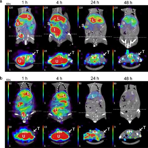 MicroSPECT CT Images Of A549 Tumor Bearing Nude Mice At 1 4 24 And