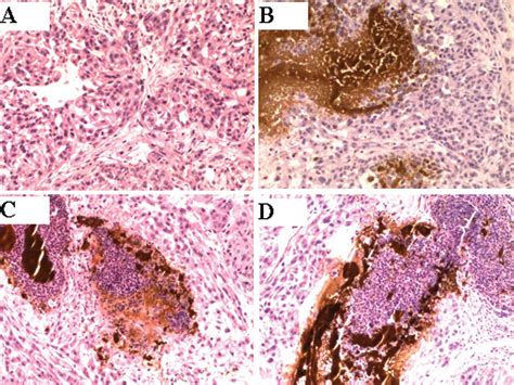 Lung Cancer Cells Vs Normal Cells