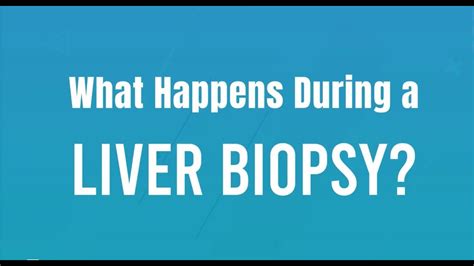 What Happens On The Day Of A Liver Biopsy Youtube