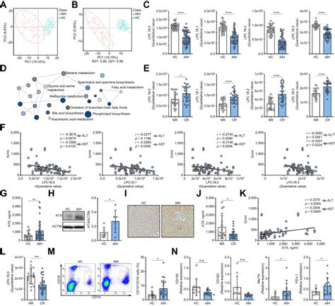 Dysregulation Of The Lpc Atx Lpa Axis In Autoimmune Hepatitis Is