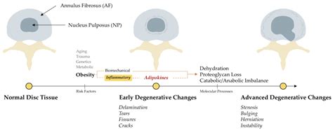 Medical Sciences Free Full Text The Role Of Adipokines In Intervertebral Disc Degeneration