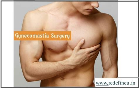 Ppt Gynecomastia In Hyderabad Gynecomastia Clinic Powerpoint Presentation Id 7937565