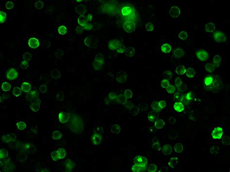 Anti Coronavirus Spike Neutralizing Antibody Chimeramab D