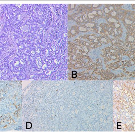 Histopathological Examination A Hematoxylin Eosin He Stain