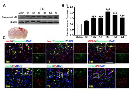 Activation Of Sigma 1 Receptor Alleviates Er Associated Cell Death And