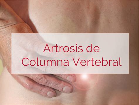 Artrosis de Columna Síntomas Causas y Tratamientos Orthokine