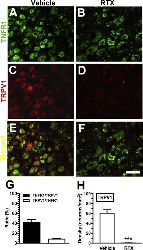 Colocalization Of Tumor Necrosis Factor Receptor Tnfr And