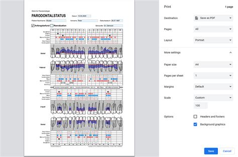 Free Periodontal Chart Use Online