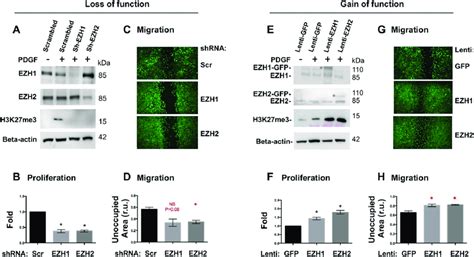 Effect Of EZH1 Or EZH2 Gain Or Loss Of Function On Smooth Muscle Cell