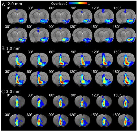 Frontiers Tuning Neuromodulation Effects By Orientation Selective