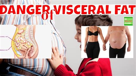 Visceral Fat Do You Know The Danger Of Visceral Fat To Your Health Visceral Fat How To Stay