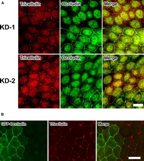 Occludin Deficiency Leads To Mislocalization Of Tricellulin A Download Scientific Diagram