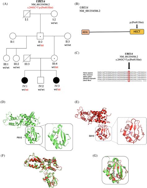 Undiagnosed Rare Disease Clinic Identifies A Novel UBE3A Variant In Two