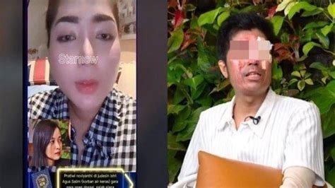 Update Kasus Agus Korban Penyiraman Air Keras Harapan Pratiwi